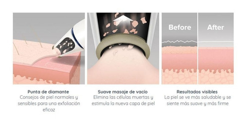 Imagen 4 de 8 de Microdermabrasion Punta Diamante Exfolia Homedics Mda-100