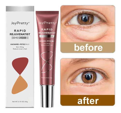 Crema Instantánea Para Eliminar Ojeras Y Ojeras