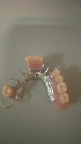 Imagen 3 de 5 de Laboratorio Dental.protesis Comunes Y Flexibles