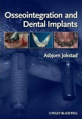 Osseointegration And Dental Implants - Asbjorn Jokstad (h...