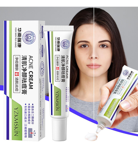 Creme De Gel Salicílico Atenuante Para Remoção De Impressão