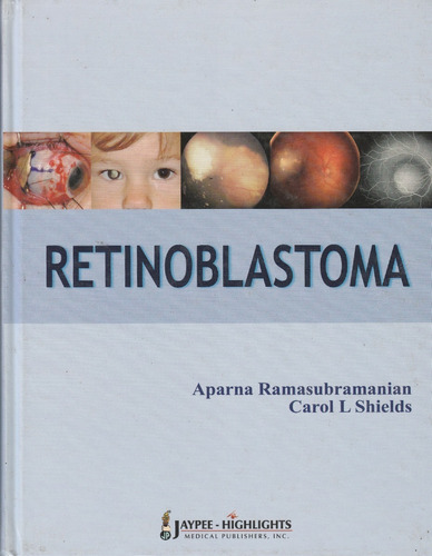 Retinoblastoma Aparna Ramasubramanian/ Carol L Shields