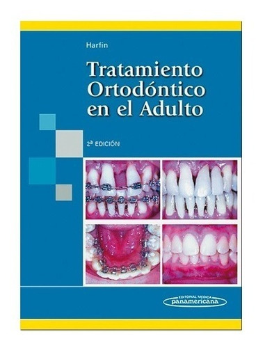 Tratamiento Ortodontico En El Adulto - Harfin [2ª Edicion]