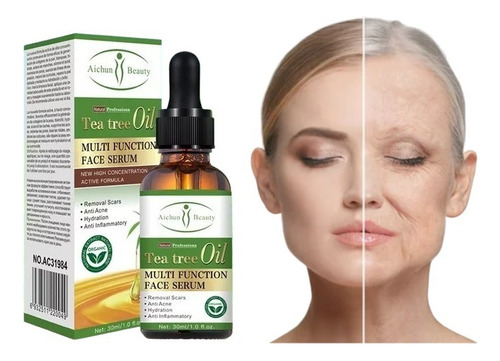 Serum Facial Tea Tree Oil 30 Ml Anti Acné Remueve Manchas
