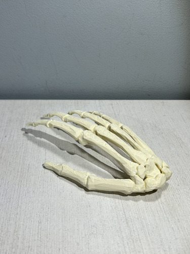 Huesos De La Mano - Impresión 3d