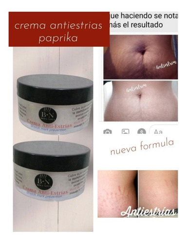 Kit 2 Cremas Paprika Con Jengibre Para Estrías, Cicatrices.