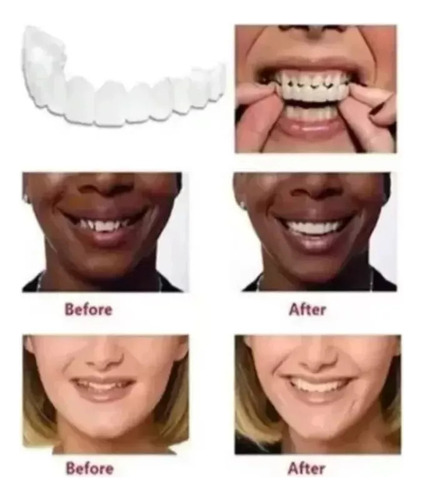 Silicone Superior/inferior Sorriso Dentes Falsos Folheados W
