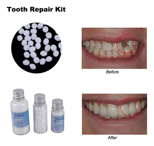 Cola Adesiva Dentes Espaços Dentes Postiços 30g