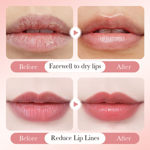 O Hidratante Blanqueador De Labios Labios Oscuros Lightenin