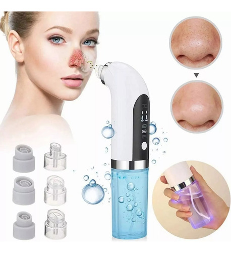 Facial Microdermobracion Extractor Puntos Negros Espinillas