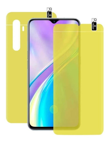 Protetor Gel Frente E Verso Xiaomi Mi9t Mi 9t  Frete Gratis