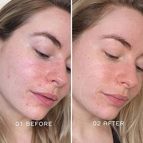 Ren Clean Skincare Glow Tonic - Iluminador Facial Diario - E