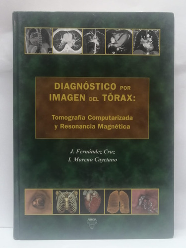 Libro Diagnostico Por Imagen Del Torax