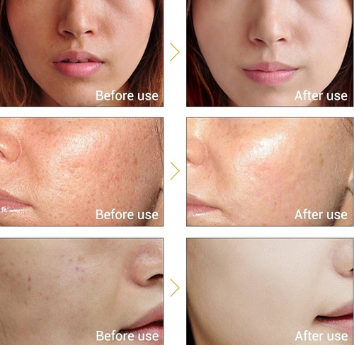 Lanbena Vitamina C Serum Con Acido Hylaronico 15ml