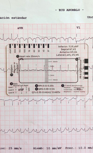 Regla 7 Pasos Para Lectura De Ecg Rcp Interpretación