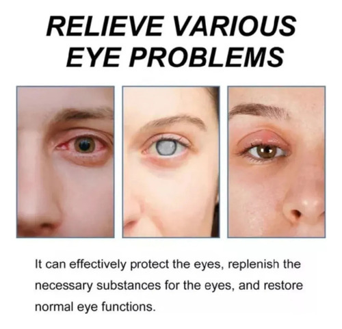 Gotas Para La Salud Ocular, Gotas Relajantes Para Ojos Secos