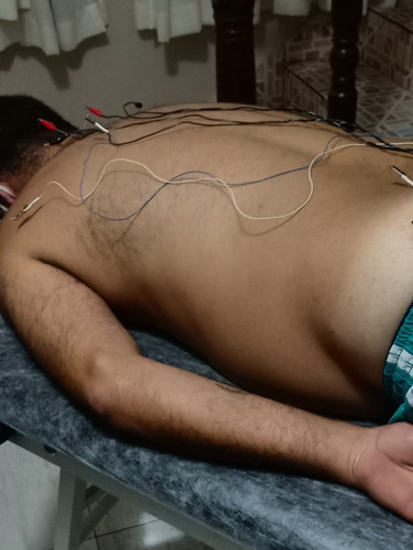 Imagem 4 de 5 de Acupuntura E Massagem Em Domicílio, Mande Mensagem No Whats.
