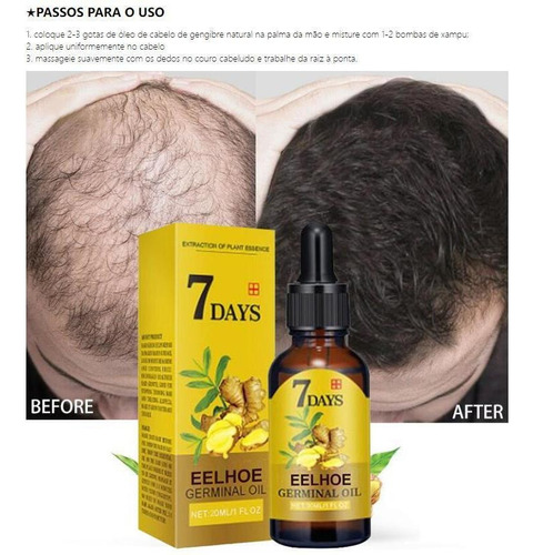 Kit De Produtos Para Cabelos Longos, Estimulando O Crescimen
