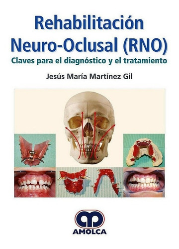 Rehabilitacion Neuro-oclusal Rno Diagnostico Y Tratamient...