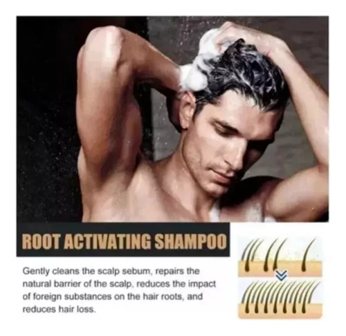 ChampĂș Root Activator Para El Crecimiento Del Cabello Para H