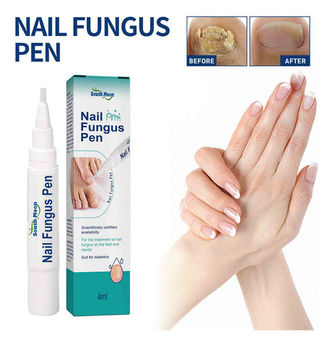 Para Melhorar As Unhas Dos Pés, Unhas E Pés Infectados 3ml