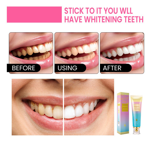Pasta De Dientes Bodyaccel Blanqueadora Con Niacinamida Y Qu