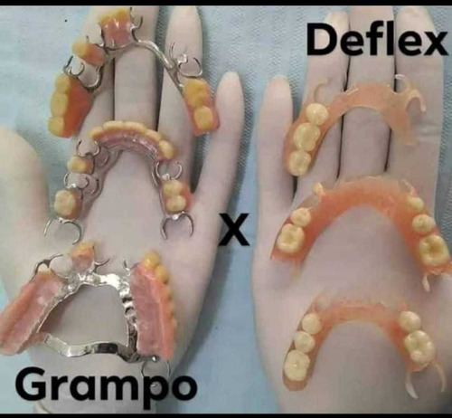 Imagem 2 de 3 de Prótese Deflex Facilitada No Boleto