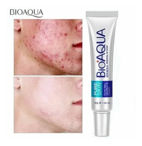 Crema Anti Acne Bioaqua Pure Skin Cicatrices Control Grasa