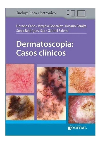 Cabo Dermatoscopia: Casos Clínicos Novedad Nuevo !