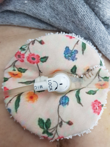 Protectores Para Botón Gástrico Reutilizables X 7 Unidades