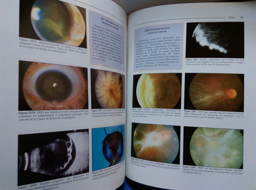 Cărți de oftalmologie medicală