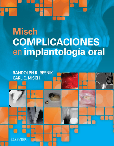 Misch Complicaciones En Implantología Oral ¡ !