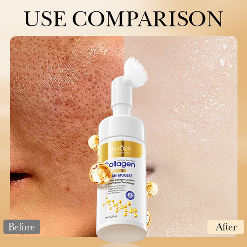 S Cleansing Mouss Limpeza Facial De Limpeza De Poros 120 Ml