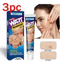 Comprar Creme Para Remover Verrugas E Lunares Para Remover Marcas De