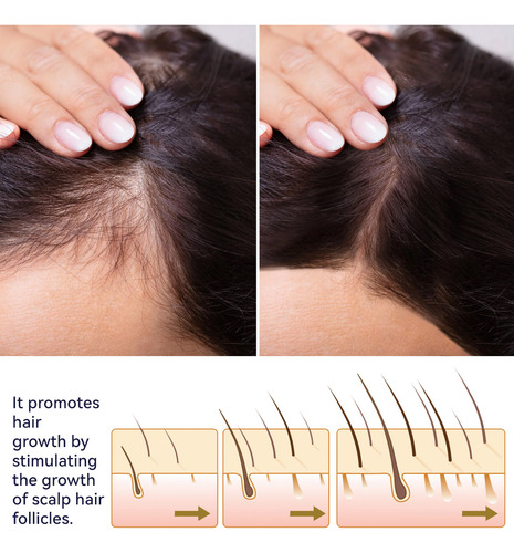 I Hair Growth Spray Nutre Cabelos Longos, Grossos E Fortes R
