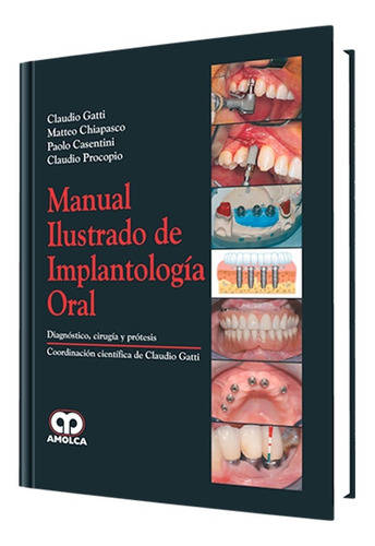 Manual Ilustrado De Implantología Oral. Editorial Amolca 
