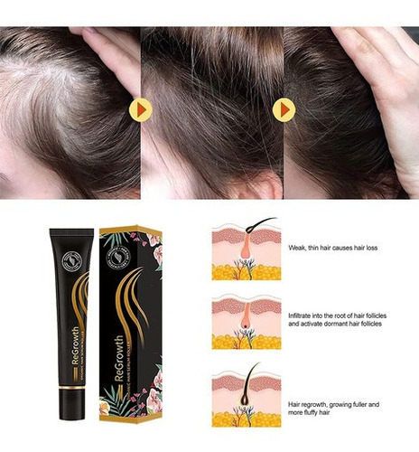 Conjunto De Rolos De Soro De Cabelo Orgânico Regenerador 4pc