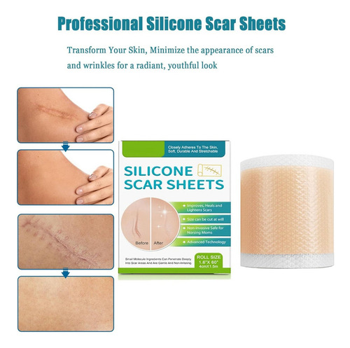 . Láminas De Silicona Profesionales For Cicatrices