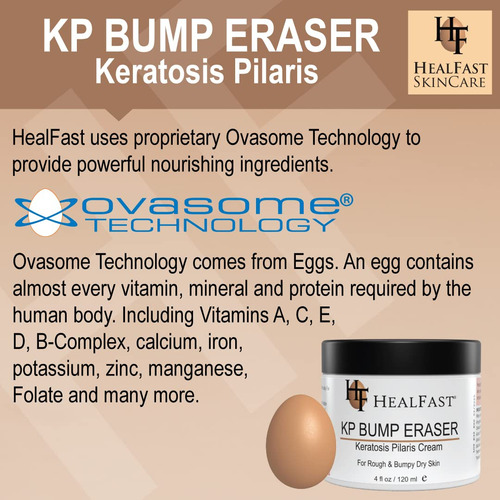 Crema De Borrador De La Protuberancia De Kp Kp Para La Piel