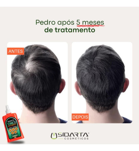 Kit Das Famosas: Tônico Sidarta, Shampoo E Condicionador