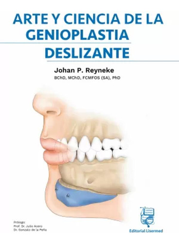 Arte Y Ciencia La Genioplastia Deslizante -  -(t.dura) - *