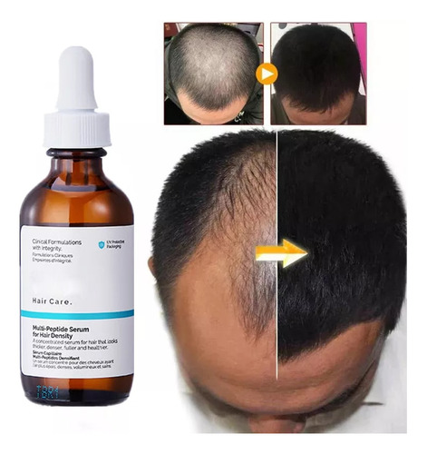 Aceite Esencial Original Hair Authentic Care Growth Ordinary