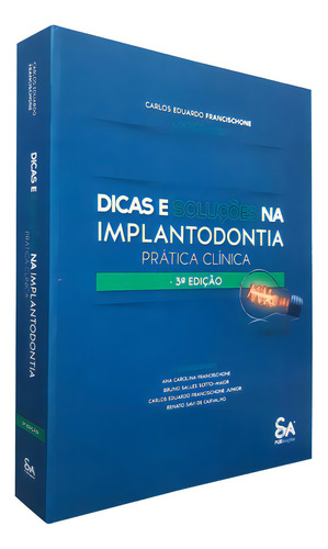 Dicas E Soluções Na Implantodontia: Prática Clínica, De Carlos Eduardo Francischone. Livraria Santos Editora Comércio E Importação Ltda., Capa Dura, Edição 3 Em Português, 2022
