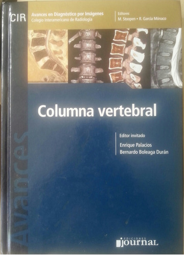 Columna Vertebral Diagnóstico Por Imágenes.