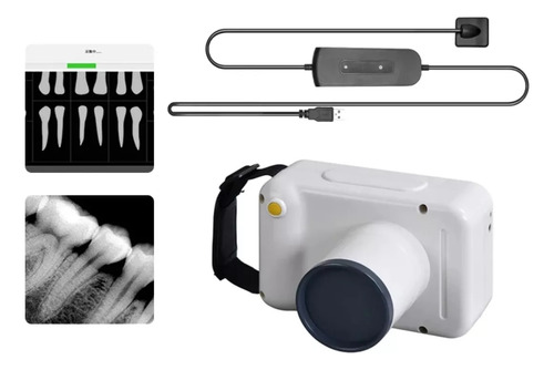 Raio-x Portátil + Sensor Digital Odontológico E Veterinário