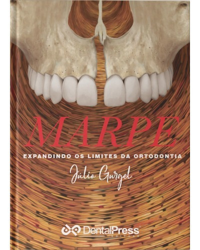 Marpe: Expandindo Os Limites Da Ortodontia, De Julio Gurgel. Editora Dental Press, Capa Mole, Edição 1 Edição Em Português, 2019