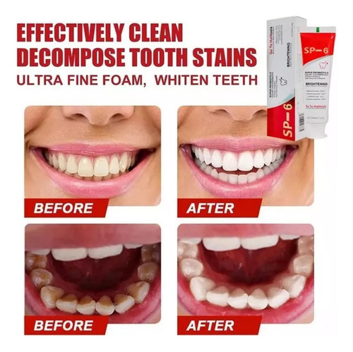 Pasta Clareadora Dental Cc Sp-6 Fresh Breath, 2 Unidades