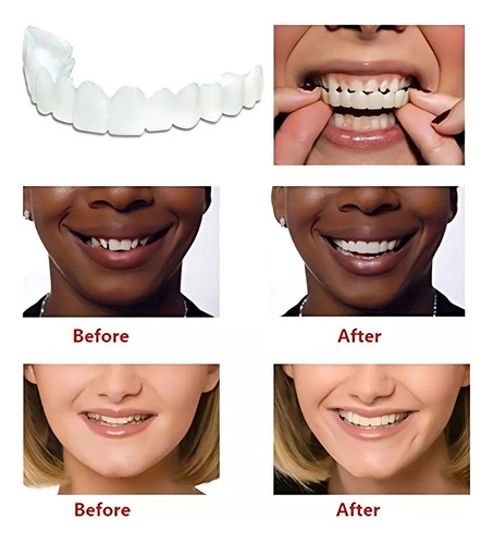Novo Silicone Superior/inferior Sorriso Dentes Falsos