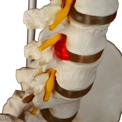 Modelo Anatómico De La Columna Vertebral (columna Vertebral)