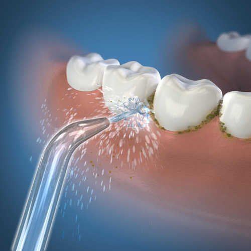 Repuesto De Punta De Hilo Dental Waterpik Classic Jt-100e, P